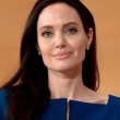 Angelina Jolie revela que foi diagnosticada com paralisia facial