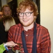 Após acidente, Ed Sheeran não percebeu fraturas e foi para balada